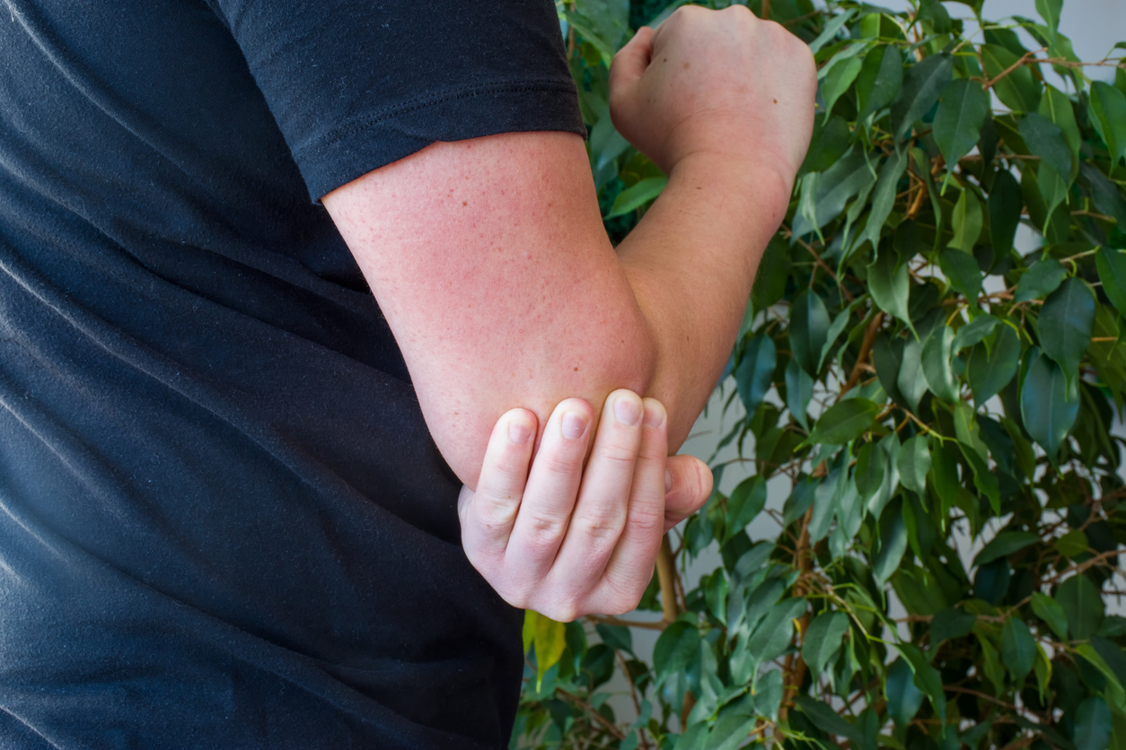  Close-up of a man in a blue shirt holding his injured elbow