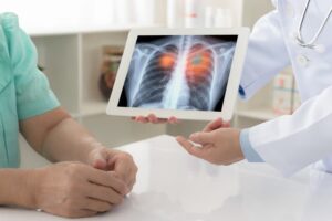 A doctor showing a patient with lung disease a chest X-ray
