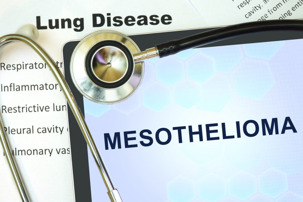 A tablet with the word mesothelioma with a stethoscope and paper that says lung disease